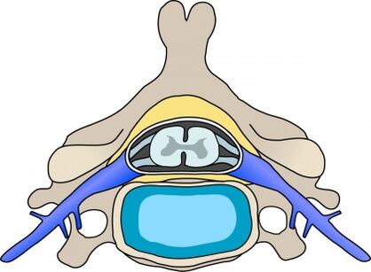Protabius v vretenci z osteohondrozo materničnega vratu